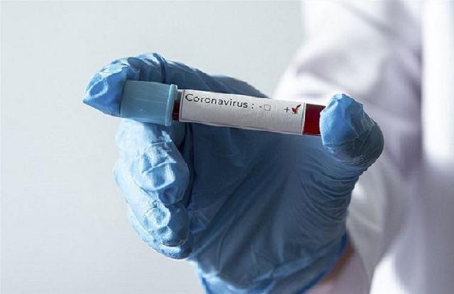 Dünyada koronavirusa yoluxanların sayı 2 milyonu ötüb