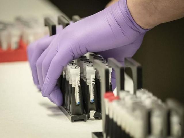 Daha iki nəfər koronavirusdan öldü: 79 yeni yoluxma - FOTO