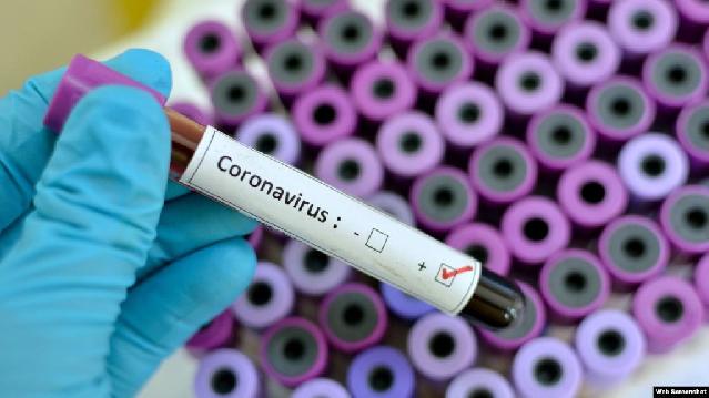 40 jurnalistimiz koronavirusa yoluxub, onlardan 5-i vəfat edib