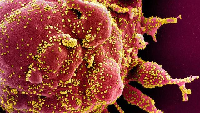 Koronavirusun yeni ştammı öldürücüdür?