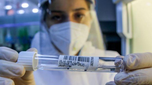 Azərbaycanda son sutkada daha 27 nəfər koronavirusa yoluxub